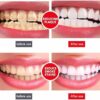 Sp-4 Ultra Whitening Toothpaste
