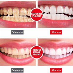 Sp-4 Ultra Whitening Toothpaste